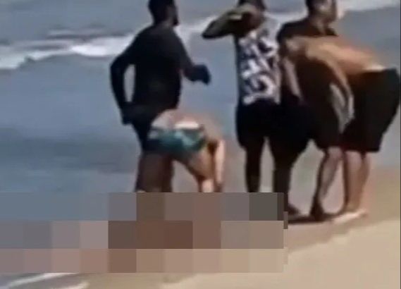 Dječaku (11) ajkula otkinula nogu: Molio spasioce da ne dozvole da umre!